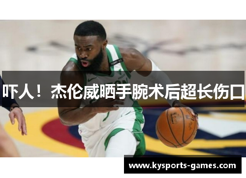 吓人！杰伦威晒手腕术后超长伤口